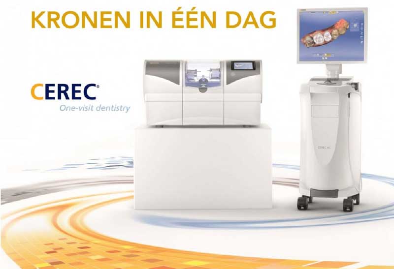 Cerec One visit dentistry Tandartspraktijk Rivierenbuurt