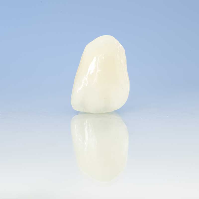 porceleinen-facing-tandartspraktijk-rivierenbuurt